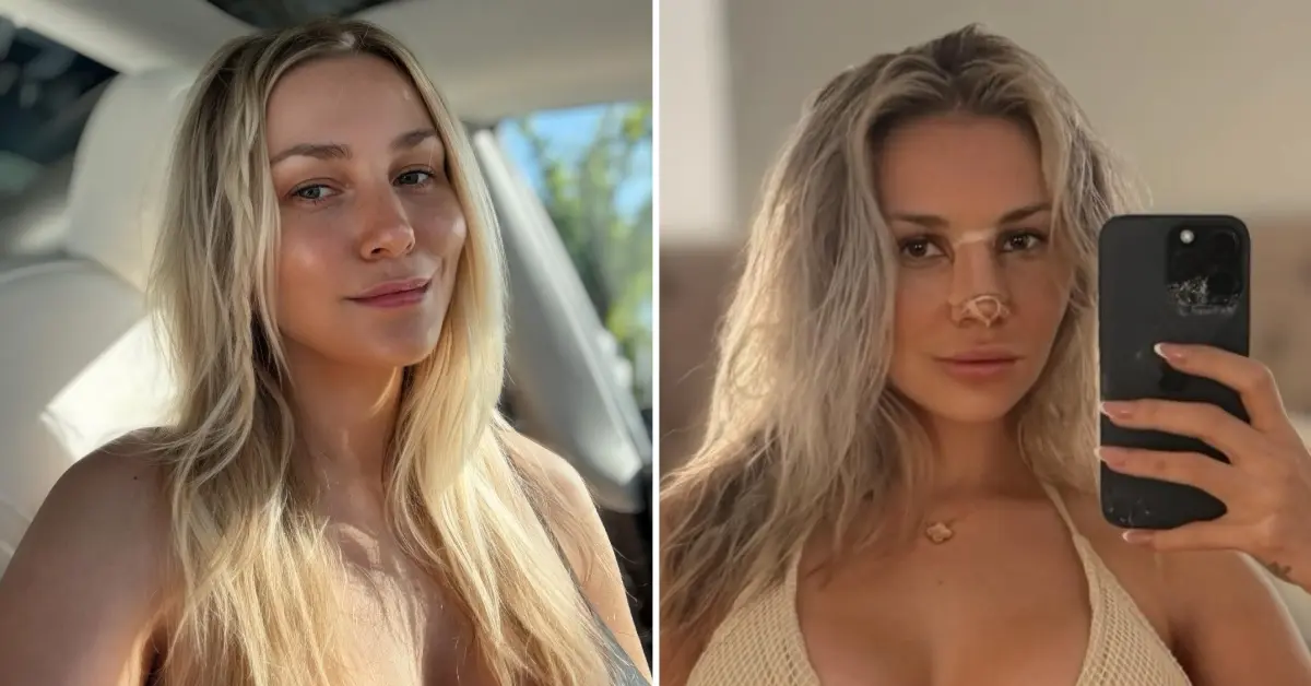 Courtney Stodden Reveals Nose Job Results in Stunning Photo and Raves Over ‘Self-Love’